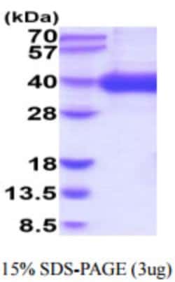 Novus Biologicals&trade;&nbsp;Human CD1a Recombinant Protein